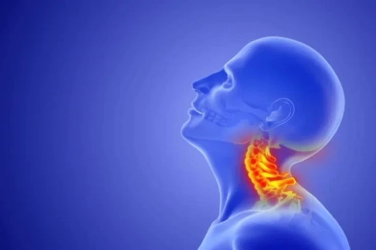 Cervical Disc Replacement---------12