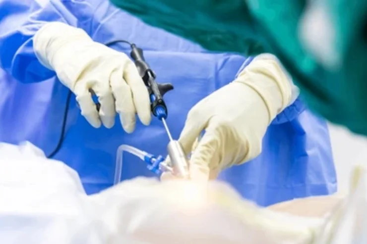 Minimally Invasive Spine Surgery (MISS)