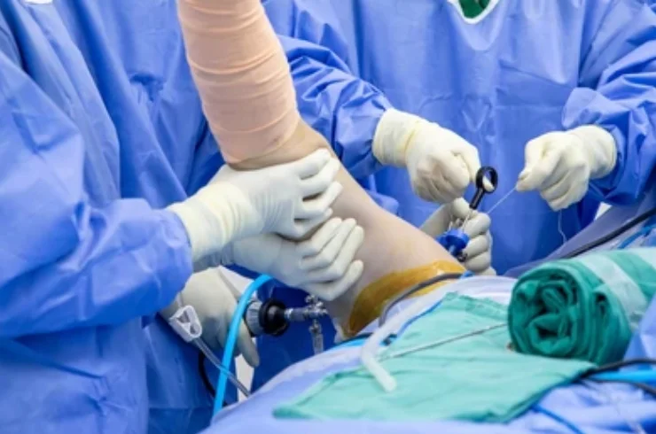 Rotator Cuff Tears Surgery-----------12