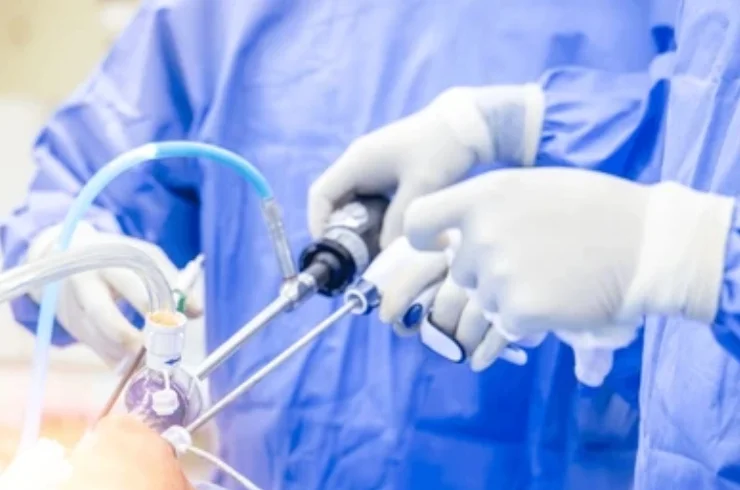 Shoulder Arthritis Surgery-------12