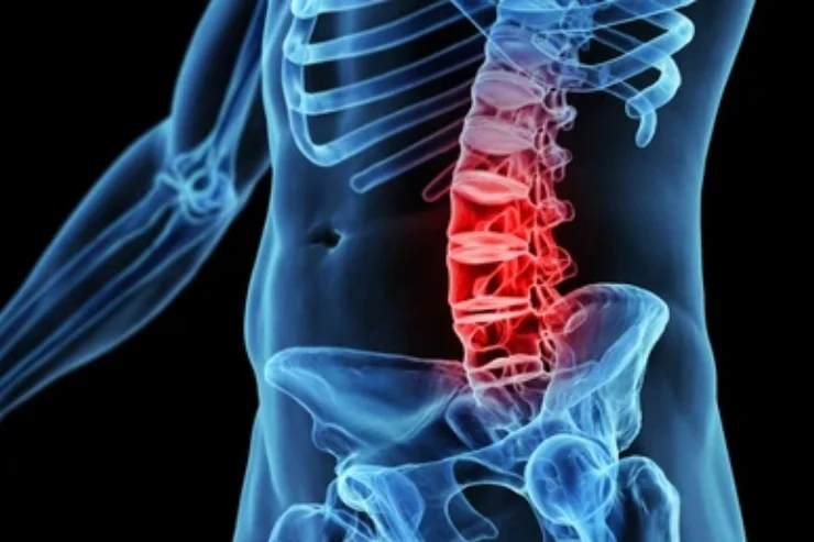Spinal Infections-----------12