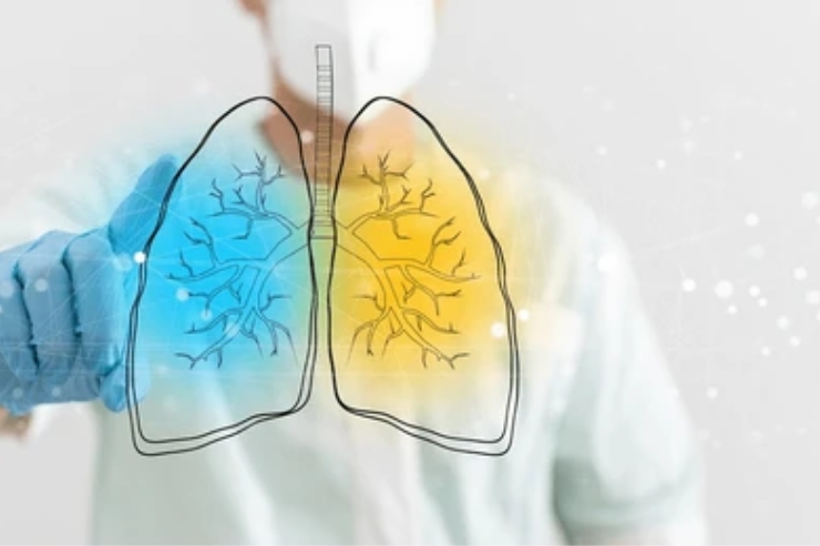 Pulmonology-----17